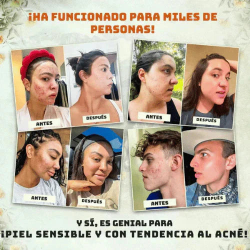 Evil Goods® - ¡¡Reduce arrugas. Elimina acné. Mejora tu piel!!